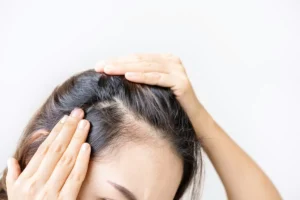 Common causes of male hair thinning