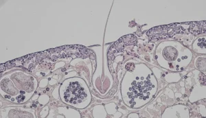 Microscopic view of hair follicle under steroid influence